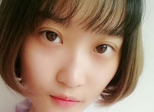 切開雙眼皮多少錢?割雙眼皮真實案例多對比圖分享