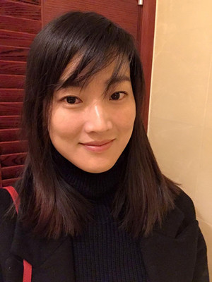 濟(jì)南愛容路傳燕醫(yī)生做的激光去黃褐斑，大家快來看看果如何
