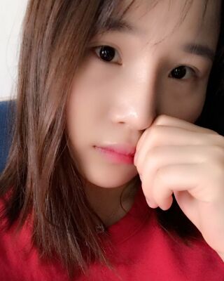 仇侃敏韓式隆鼻整形恢復(fù)果對比照片