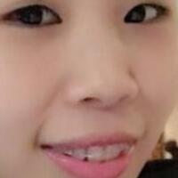 牙齒矯正的適宜年齡，多對(duì)比圖真實(shí)案例分享——成都格林口