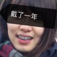 成都牙齒矯正前后對(duì)比圖分享——成都格林口腔