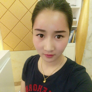 武漢美都張召醫(yī)生做的自體脂肪豐額頭+太陽穴，真實案例分享
