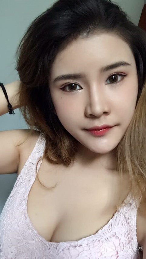 淄博陽光整形自體脂肪隆胸前后對比圖，真實案例
