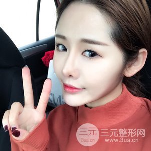 南京美萊陳天杰自體脂肪填充全臉 女神的養(yǎng)成記！