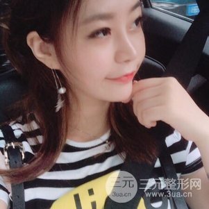 上海九院鼻部韓式生科芭比線條修復(fù)