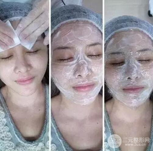 我做了光子嫩膚幾天起而且價(jià)格便宜前后對(duì)比照片案例