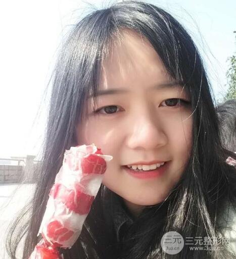 怎樣減掉雙下巴？雙下巴吸脂后個人經(jīng)歷 價格略貴但果好