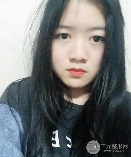 怎樣減掉雙下巴？雙下巴吸脂后個人經(jīng)歷 價格略貴但果好