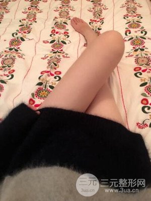珠海萊茵門診部盧剛給我做的大腿抽脂手術(shù)，前后對比圖分享