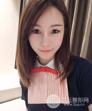 武漢美都張召醫(yī)生給我做的隆鼻整形手術(shù)，給大家分享一下前后照片