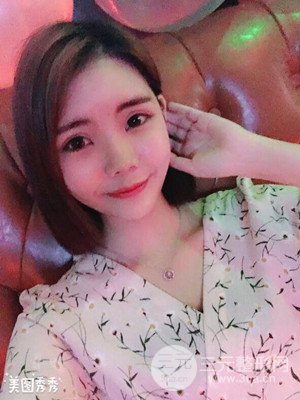 自體脂肪填充全臉真實案例——濟(jì)南愛容張慶國醫(yī)生做的