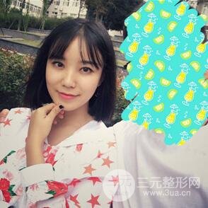 雙眼皮+開內眼角手術前后對比圖片，真實案例