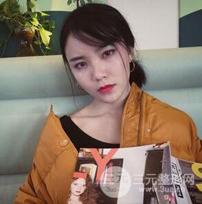 雙眼皮+開內眼角手術前后對比圖片，真實案例