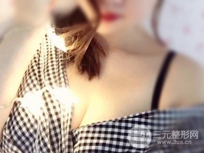 宜昌中愛張宜彬醫(yī)生給我做的假體隆胸手術，分享一下前后照片