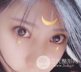 成都嬌點(diǎn)李競割雙眼皮價(jià)格和案例