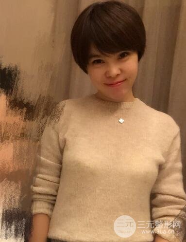 去做了埋線面b提拉術果很是不錯