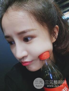 柏麗李勁良假體隆鼻案例果分享！小巧精致又立體~
