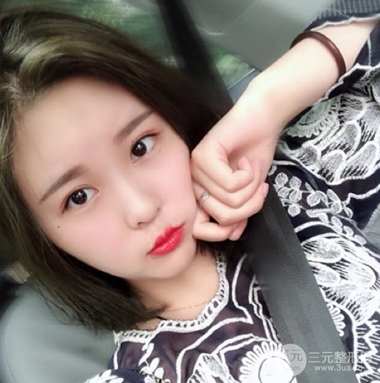 面部光纖溶脂三個月恢復(fù)記錄，妹子終于擺脫大臉盤子辣
