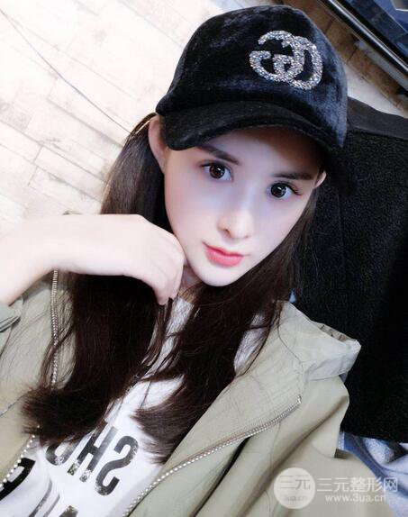 【隆鼻失敗修復(fù)】自體脂肪隆鼻隆鼻整形拯救之后可以隨意揉捏！
