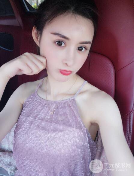 【隆鼻失敗修復(fù)】自體脂肪隆鼻隆鼻整形拯救之后可以隨意揉捏！