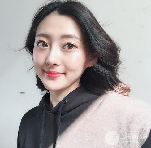 【肋軟骨隆鼻+歪鼻矯正案例】降低風險無排異，可隨意揉捏
