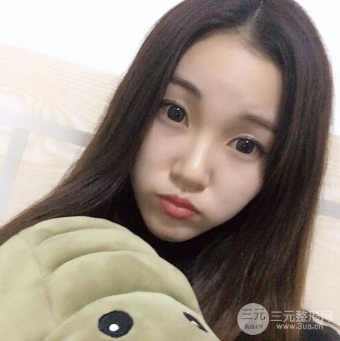 下頜角磨骨整形全過程分享，附上術(shù)后恢復(fù)照片~