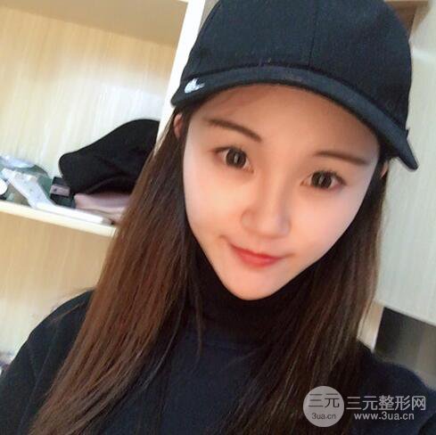 下頜角磨骨整形全過程分享，附上術(shù)后恢復(fù)照片~