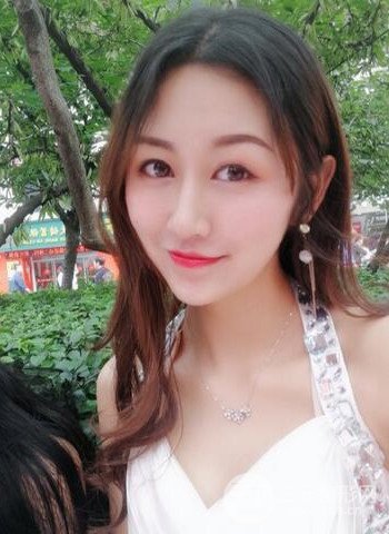 廣州隆鼻整形真實(shí)恢復(fù)期圖片，擁有精致美鼻不是夢