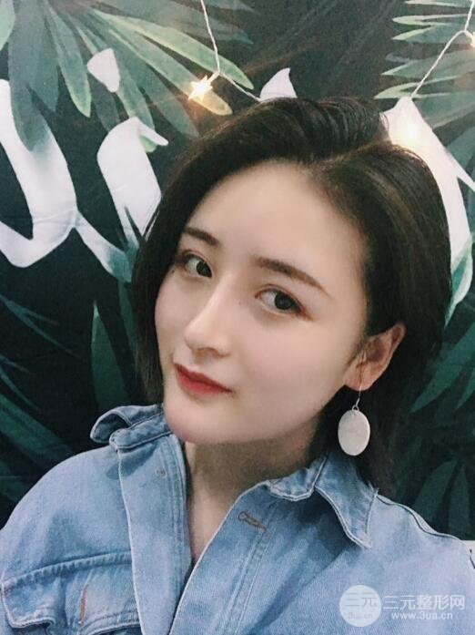 重慶五洲范文亮隆鼻整形案例，前后對比圖分享