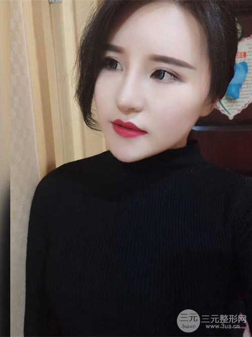 上海麗質(zhì)呂成醫(yī)生做的吸脂瘦臉日記，前后恢復(fù)圖分享