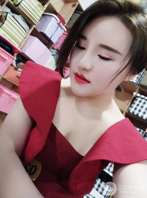 上海麗質(zhì)呂成醫(yī)生做的吸脂瘦臉日記，前后恢復(fù)圖分享