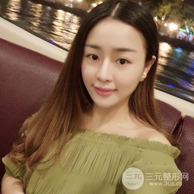 廣州藝美李闖醫(yī)生隆鼻整形恢復(fù)記錄分享~