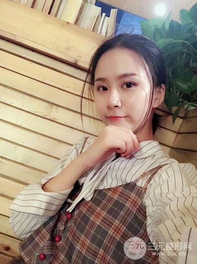 武漢伊美馨桂亮醫(yī)生自體脂肪填充面部前后對比圖恢復日記分享~