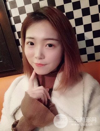 在上海諾詩做了自體脂肪填充全臉真人案例大曝光