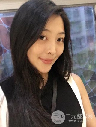 面部吸脂瘦臉手術日記分享，瘦臉果驚人