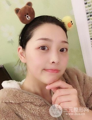 面部吸脂瘦臉手術日記分享，瘦臉果驚人