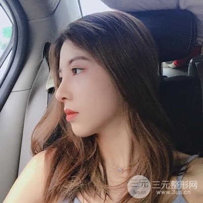 廣州藝美隆鼻日記分享！前后對(duì)比圖奉上！