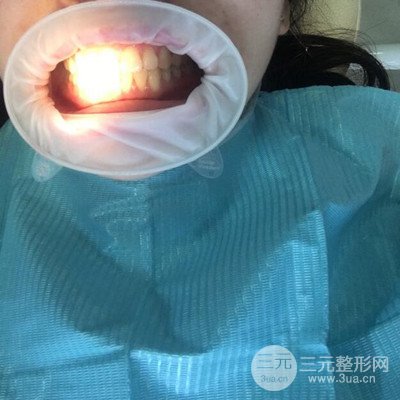 做了牙齒冷光美白果很棒，綻放美麗笑容