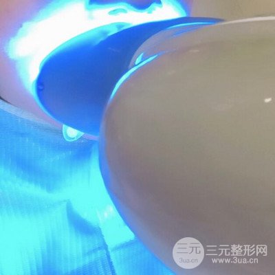 做了牙齒冷光美白果很棒，綻放美麗笑容