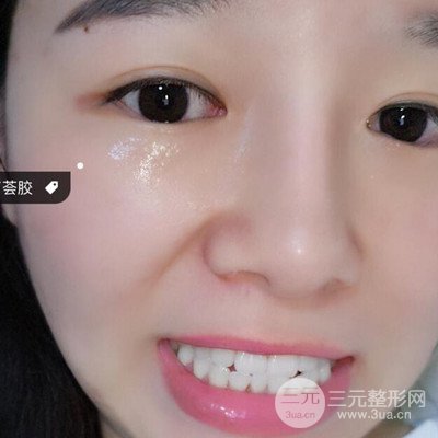 做了牙齒冷光美白果很棒，綻放美麗笑容