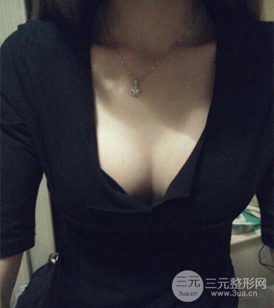 平胸妹做了假體隆胸果分享，豐滿身材不是夢