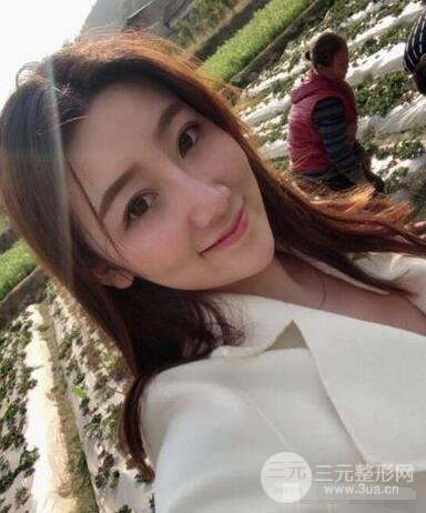 北京伊美爾徐軍隆鼻整形前后對(duì)比照片心情記錄小札