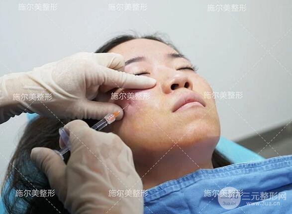 南京施爾美玻尿酸注射案例,讓蘋果肌嘭嘭嘭！