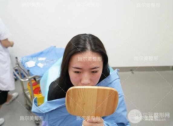 南京施爾美玻尿酸注射案例,讓蘋果肌嘭嘭嘭！