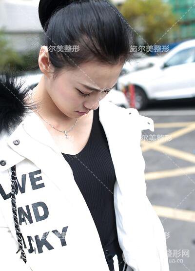 南京施爾美傲諾拉假體隆胸案例，開啟有料人生！