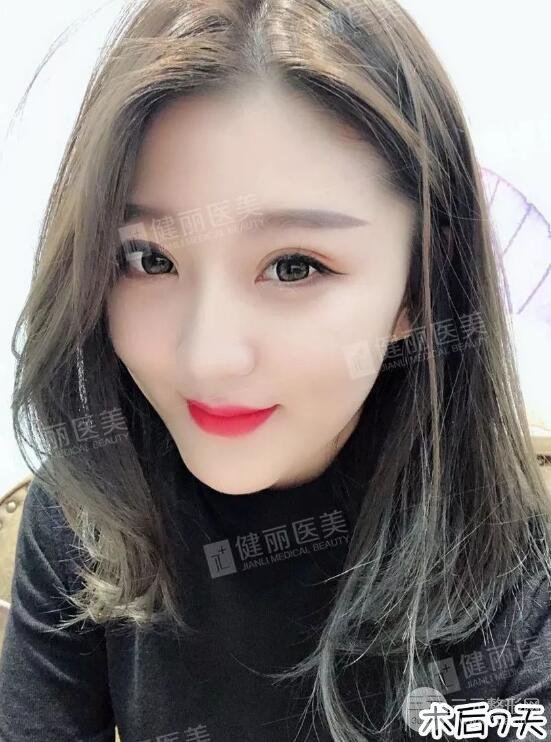 深圳健麗微創(chuàng)去眼袋+眶隔脂肪轉(zhuǎn)移術(shù)前后對(duì)比果圖分享！