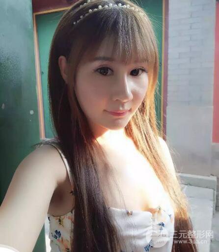 北京玉之光王明利自體脂肪豐胸案例