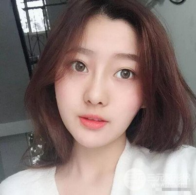 南京華美隆鼻整形前后對比圖分享