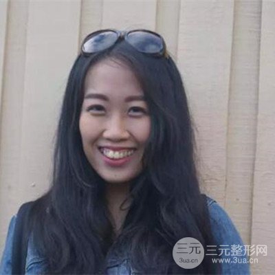 成都格林口腔唐建忠牙齒矯正案例前后對(duì)比圖分享~