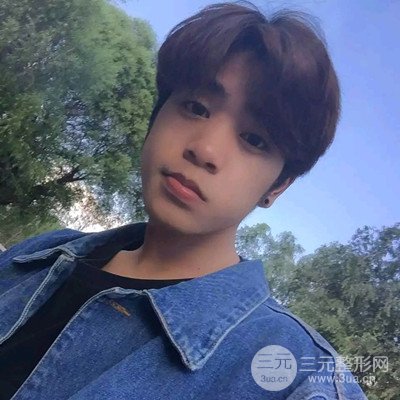 成都蜀尚蓉雅陳建華隆鼻整形前后對(duì)比照分享~